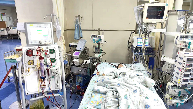 PICU里，上了ECMO+CRRT 的小依依。浙大兒院供圖